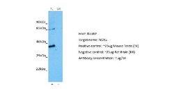 NOX5 Rabbit anti-Human, Polyclonal, Novus Biologicals 0.1 mL | Buy Online | Novus Biologicals | Fisher Scientific